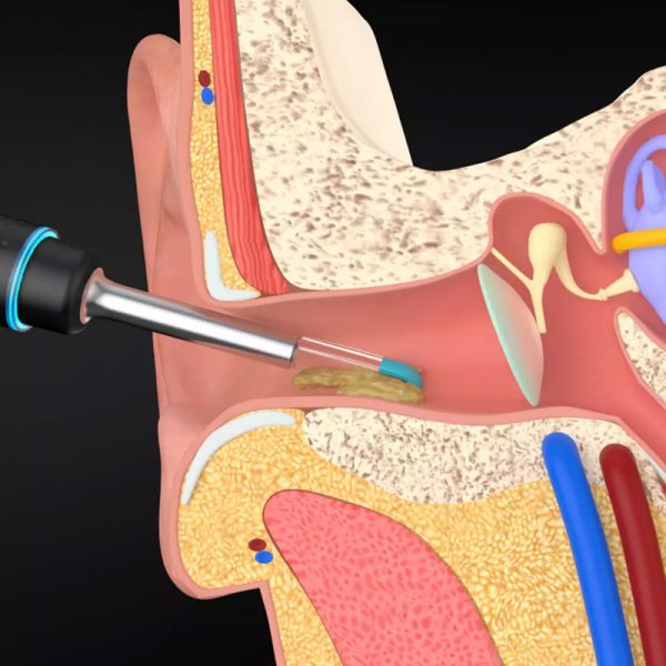 Multifunctional ear spoon set - Image 7