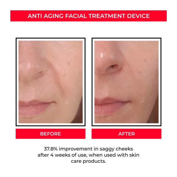 Beauty Instrument Pore Convergence EMS Skin Rejuvenation Micro Current - Image 5