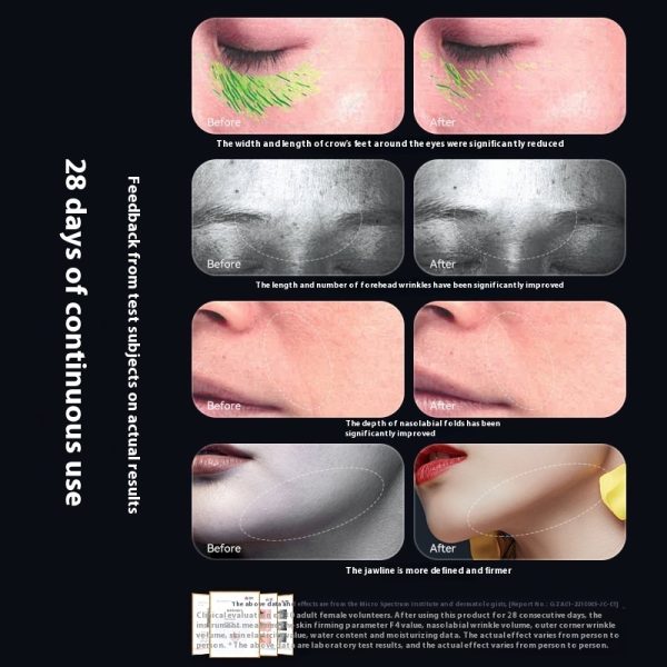 Beauty Instrument Household Color Light EMS Lifting Skin Rejuvenation Massage Cleaning 6-in-1 - Image 3